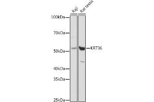 Western blot analysis of extracts of various cell lines, using (ABIN6130229, ABIN6143029, ABIN6143030 and ABIN6217868) at 1:1000 dilution. (Keratin 36 antibody  (AA 388-467))