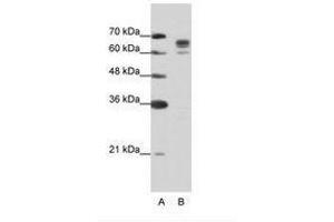 Image no. 2 for anti-DEAD (Asp-Glu-Ala-Asp) Box Polypeptide 17 (DDX17) (AA 570-619) antibody (ABIN203205)