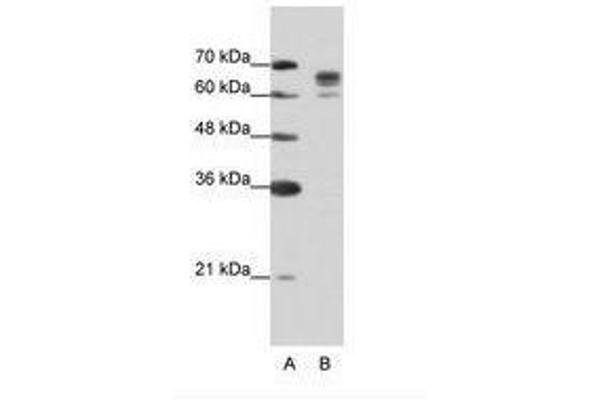 DDX17 Antikörper  (AA 570-619)