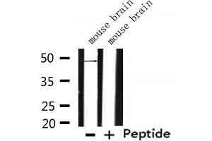 Western Blotting (WB) image for anti-Transmembrane Protease, Serine 3 (TMPRSS3) (Internal Region) antibody (ABIN6265620)