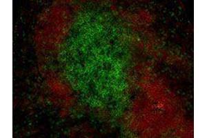 Immunofluorescence (IF) image for anti-CD19 Molecule (CD19) antibody (Alexa Fluor 594) (ABIN2656821) (CD19 antibody  (Alexa Fluor 594))