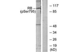 Western blot analysis of extracts from K562 cells treated with serum 10%, using Retinoblastoma (Phospho-Ser795) Antibody. (Retinoblastoma Protein (Rb) antibody  (pSer795))