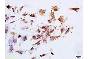 Formalin-fixed and paraffin embedded human epithelial cells tissue labeled with Anti-CK14 Polyclonal Antibody, Unconjugated at 1:300 followed by conjugation to the secondary antibody, (SP-0023), and DAB staining (pan Keratin antibody)