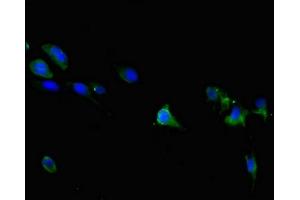 Immunofluorescent analysis of 293 cells using ABIN7172868 at dilution of 1:100 and Alexa Fluor 488-congugated AffiniPure Goat Anti-Rabbit IgG(H+L) (TRPM6 antibody  (AA 740-840))