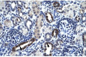 Human kidney; TSFM antibody - N-terminal region in Human kidney cells using Immunohistochemistry