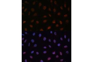 Immunofluorescence analysis of U-2 OS cells using MED25 Polyclonal Antibody (ABIN7268442) at dilution of 1:100 (40x lens). (MED25 antibody  (AA 30-200))