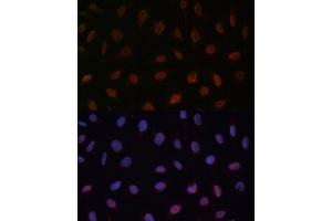 Immunofluorescence analysis of U-2 OS cells using MED25 Polyclonal Antibody (ABIN7268442) at dilution of 1:100 (40x lens).