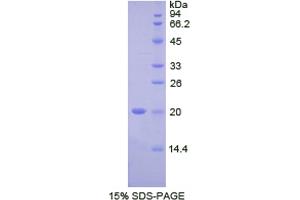 SDS-PAGE analysis of Human FcgBP Protein.