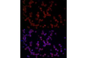 Immunofluorescence analysis of THP-1 cells using YKL-40/CHI3L1 Rabbit pAb (ABIN1679214, ABIN1679215, ABIN1679216, ABIN5664234 and ABIN6220124) at dilution of 1:50 (40x lens).