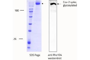 Western Blotting (WB) image for SARS-CoV-2 Spike (Trimer) protein (rho-1D4 tag) (ABIN6952669) (SARS-CoV-2 Spike Protein (Trimer) (rho-1D4 tag))