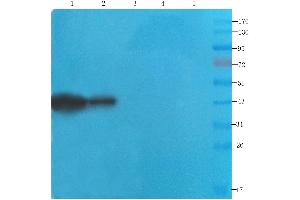 Western Blot using anti-CDCrel-1 antibody ABIN7072252 Rat brain (lane 1), mouse spinal cord (lane 2), rat testis (lane 3), human lung cancer (lane 4) and human breast cancer (lane 5) samples were resolved on a 12 % SDS PAGE gel and blots probed with ABIN7072252 at 2 μg/mL before being detected by a secondary antibody. (Recombinant Septin 5 antibody)