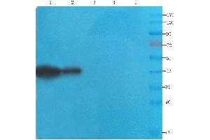 Western Blot using anti-CDCrel-1 antibody ABIN7072252 Rat brain (lane 1), mouse spinal cord (lane 2), rat testis (lane 3), human lung cancer (lane 4) and human breast cancer (lane 5) samples were resolved on a 12 % SDS PAGE gel and blots probed with ABIN7072252 at 2 μg/mL before being detected by a secondary antibody. (Recombinant Septin 5 antibody)