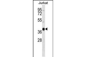 Western blot analysis in Jurkat cell line lysates (35ug/lane). (MARCH4 antibody  (C-Term))