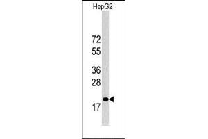Image no. 2 for anti-Cyclin-Dependent Kinase Inhibitor 1B (p27, Kip1) (CDKN1B) (C-Term) antibody (ABIN358766) (CDKN1B antibody  (C-Term))