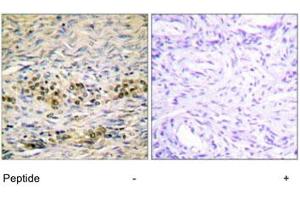 Immunohistochemistry analysis of paraffin-embedded human ovary tissue using AKT1 polyclonal antibody . (AKT1 antibody)