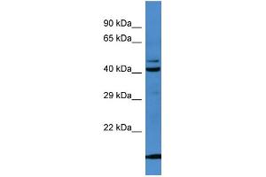 Western Blotting (WB) image for anti-serpin Peptidase Inhibitor, Clade B (Ovalbumin), Member 8 (SERPINB8) (N-Term) antibody (ABIN2774201) (SERPINB8 antibody  (N-Term))