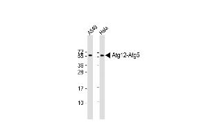 All lanes : Anti-G12L Antibody (E3) at 1:2000 dilution Lane 1: A549 whole cell lysate Lane 2: Hela whole cell lysate Lysates/proteins at 20 μg per lane. (ATG12 antibody  (N-Term))