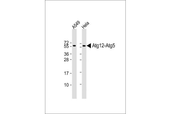ATG12 anticorps  (N-Term)