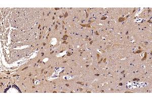 Detection of AST2 in Rat Spinal cord Tissue using Polyclonal Antibody to Aspartate Aminotransferase 2 (AST2) (AST2 (AA 30-430) antibody)