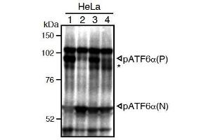 Western Blotting (WB) image for anti-Activating Transcription Factor 6 (ATF6) (N-Term) antibody (ABIN2451923) (ATF6 antibody  (N-Term))