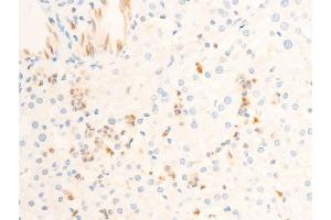 ABIN6255938 and ABIN6267302 at 1/100 staining human liver tissue sections by IHC-P. (ICAM1 antibody  (pTyr512))
