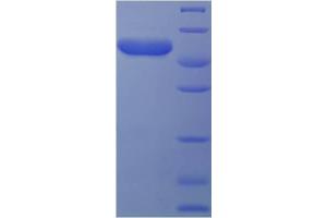 SDS-PAGE (SDS) image for Clavesin 2 (CLVS2) (AA 1-327), (full length) protein (His-SUMO Tag) (ABIN5711391)