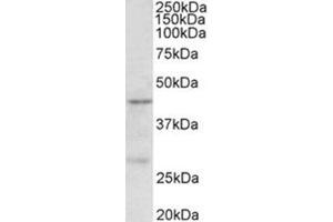 Western Blotting (WB) image for anti-Protein Arginine Methyltransferase 6 (PRMT6) (Internal Region) antibody (ABIN1108736) (PRMT6 antibody  (Internal Region))