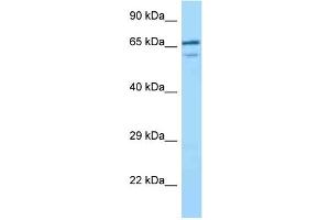 WB Suggested Anti-VILL Antibody Titration: 1. (VILL antibody  (C-Term))
