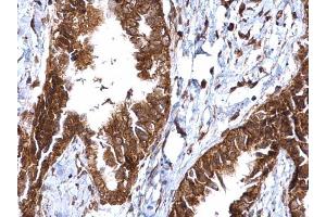 Immunohistochemistry (IHC) image for anti-Matrix Metalloproteinase 2 (MMP2) antibody (ABIN2855854)