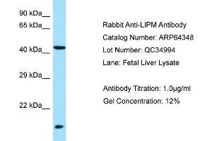Western Blotting (WB) image for anti-Lipase, Family Member M (LIPM) (N-Term) antibody (ABIN2789813) (LIPM antibody  (N-Term))