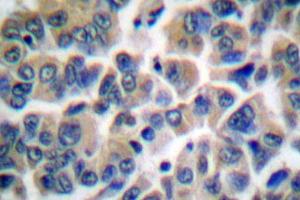 Image no. 2 for anti-Friend Leukemia Virus Integration 1 (FLI1) antibody (ABIN265422) (FLI1 antibody)
