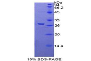 SDS-PAGE (SDS) image for Retinoic Acid Receptor, alpha (RARA) (AA 237-459) protein (His tag) (ABIN1879673) (Retinoic Acid Receptor alpha Protein (AA 237-459) (His tag))