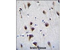 MeCP2 Antibody (N-term S80) (ABIN655914 and ABIN2845313) immunohistochemistry analysis in formalin fixed and paraffin embedded human brain tissue followed by peroxidase conjugation of the secondary antibody and DAB staining. (MECP2 antibody  (N-Term))