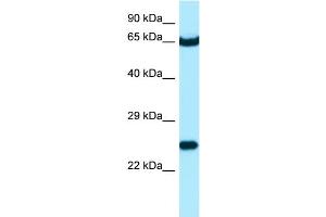 WB Suggested Anti-STXBP3 Antibody Titration: 1. (STXBP3 antibody  (C-Term))