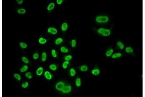 Immunofluorescence analysis of U2OS cells using MCM6 Polyclonal Antibody (MCM6 antibody)