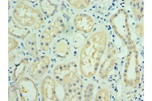 Immunohistochemistry of paraffin-embedded human kidney tissue using ABIN7143736 at dilution of 1:100 (FUT6 antibody  (AA 170-359))