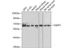 Western blot analysis of extracts of various cell lines using CNDP1 Polyclonal Antibody at dilution of 1:1000. (CNDP1 antibody)