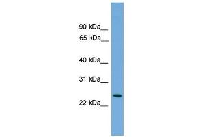 WB Suggested Anti-PSME2 Antibody Titration: 0. (PSME2 antibody  (Middle Region))
