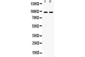 Western blot analysis of Caldesmon expression in rat skeletal muscle extract ( Lane 1) and HELA whole cell lysates ( Lane 2). (Caldesmon antibody  (AA 1-120))