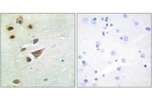 Immunohistochemistry analysis of paraffin-embedded human brain tissue, using NT5C3 Antibody. (NT5C3 antibody  (AA 11-60))