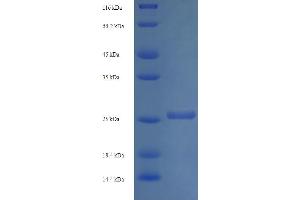 SDS-PAGE (SDS) image for ADP-Ribosylation Factor-Like 4A (ARL4A) (AA 2-200) protein (His tag) (ABIN5709079) (ARL4A Protein (AA 2-200) (His tag))