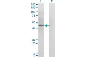 Western Blot analysis of ACAT2 expression in transfected 293T cell line by ACAT2 monoclonal antibody (M01), clone 4A5. (ACAT2 antibody  (AA 1-397))