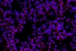 Immunofluorescent analysis of paraformaldehyde-fixed mouse lung usingp38IP (ABIN7075954) at dilution of 1: 400 (Transcription Factor SPT20 Homolog (SUPT20H) antibody)