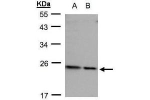 WB Image Sample(30 ug whole cell lysate) A: HeLa S3, B: Hep G2, 12% SDS PAGE diluted at 1:500 (RPL17 antibody)