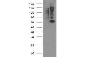 HEK293T cells were transfected with the pCMV6-ENTRY control (Left lane) or pCMV6-ENTRY PPM1B (Right lane) cDNA for 48 hrs and lysed. (PPM1B antibody)