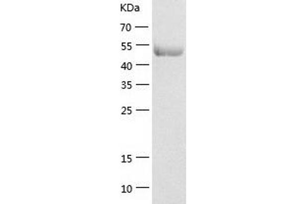 EEF1G Protein (AA 1-437) (His tag)