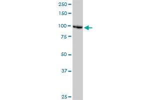 DDX11 monoclonal antibody (M03), clone 3C1. (DDX11 antibody  (AA 1-970))