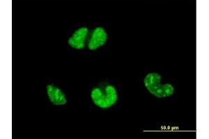 Immunofluorescence of monoclonal antibody to ESR2 on HeLa cell. (ESR2 antibody  (AA 22-121))