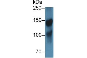 Western blot analysis of Pig Cerebrum lysate, using Rabbit Anti-Human ICAM5 Antibody (1 µg/ml) and HRP-conjugated Goat Anti-Rabbit antibody (abx400043, 0.