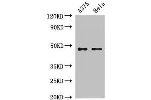 Western Blot Positive WB detected in: A375 whole cell lysate, Hela whole cell lysate All lanes: RPL4 antibody at 2 μg/mL Secondary Goat polyclonal to rabbit IgG at 1/50000 dilution Predicted band size: 48 kDa Observed band size: 48 kDa